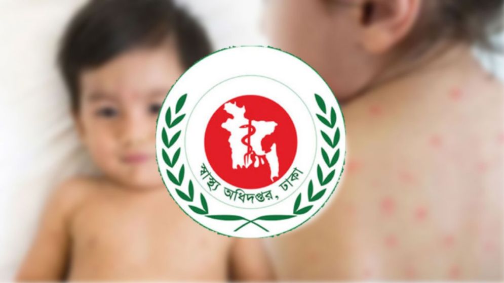 হামের উপসর্গে প্রাণ গেলো আরও ১৬ শিশুর