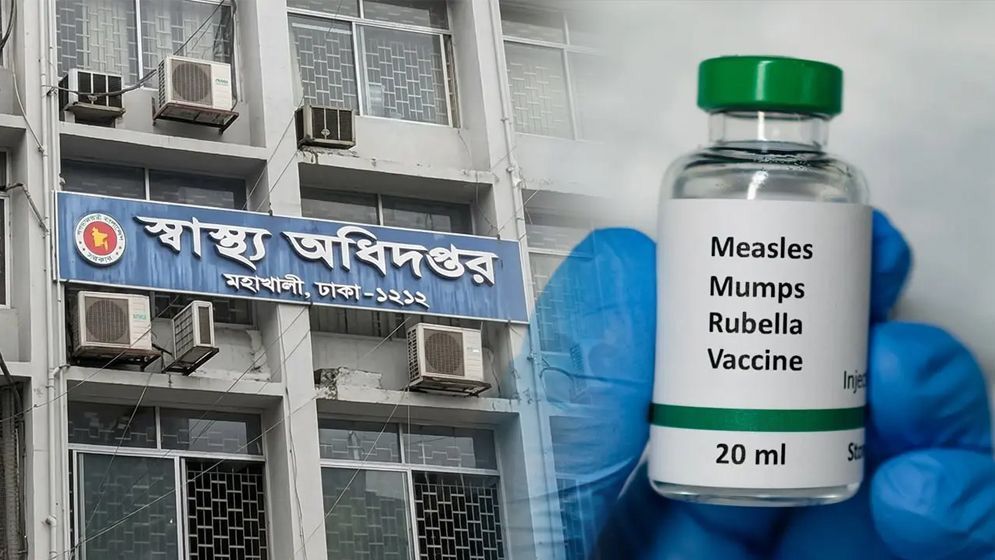 ২৪ ঘণ্টায় হাম উপসর্গে ৪ জনের মৃত্যু