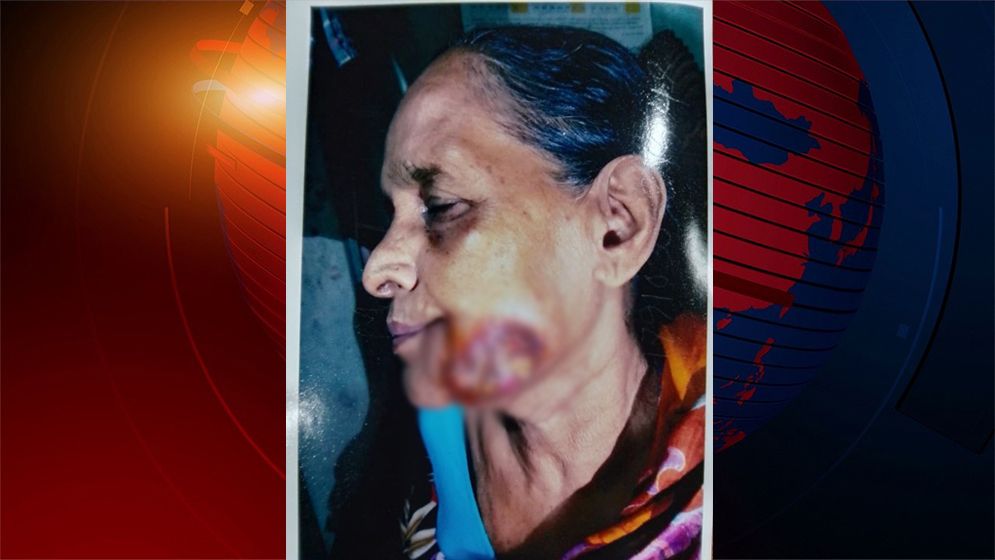 অর্থের অভাবে থমকে আছে ক্যান্সার আক্রান্ত হেনারার চিকিৎসা