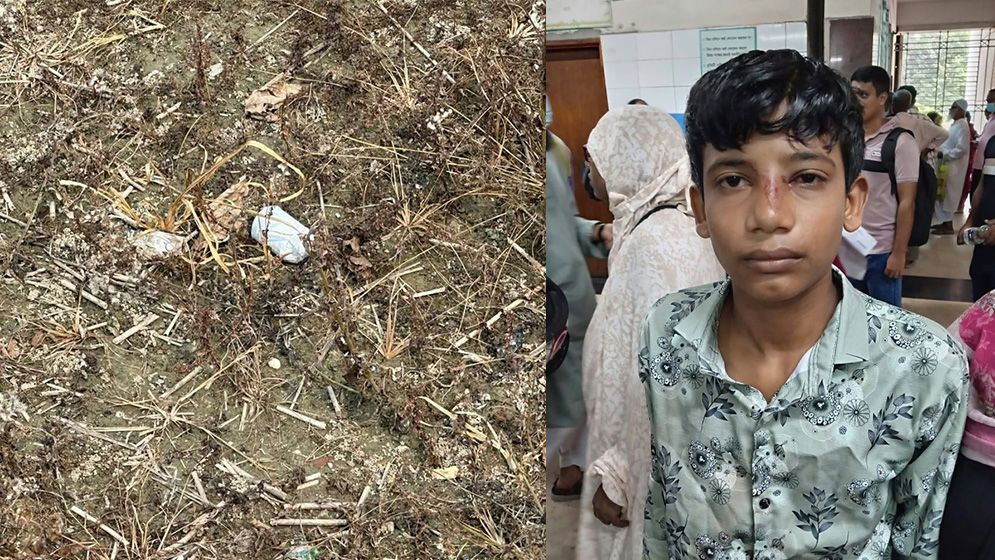 খেলনা ভেবে হাতে ককটেল, বিস্ফোরণে আহত কিশোর